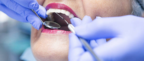 Best Emergency Wisdom Tooth Extraction in Manorhaven, NY